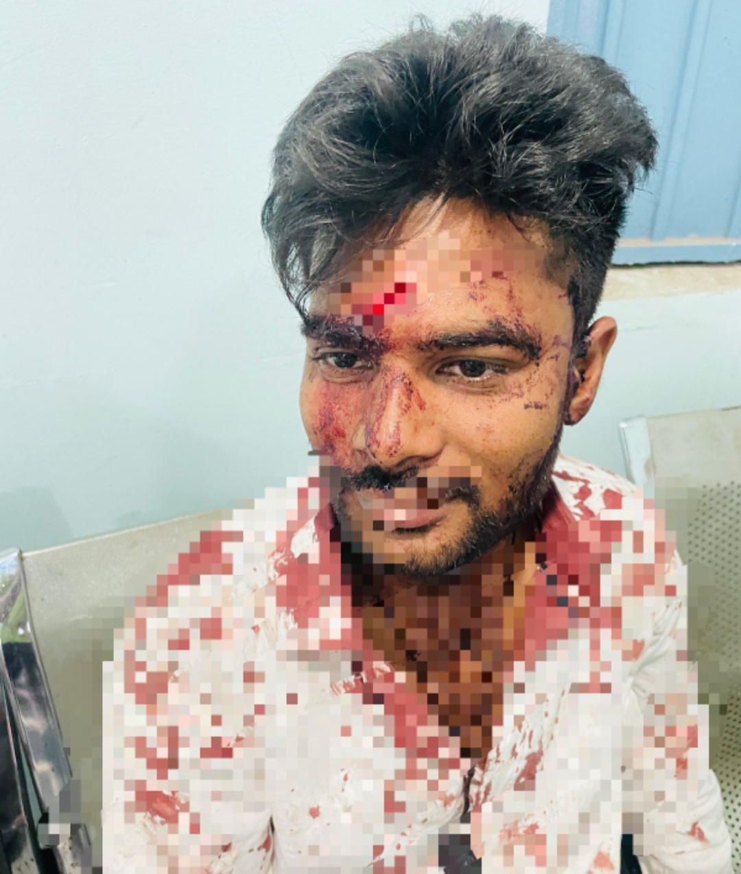 रायपुर में चाकूबाजी- घायल को थाने में बैठाया, आरोपियों को बचाने के आरोप- पुलिस पर उठे सवाल