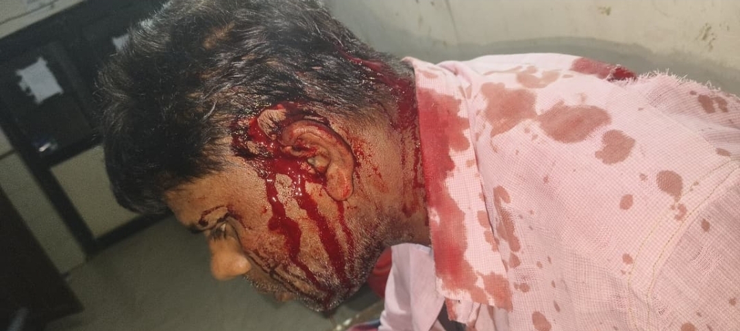 रायपुर एयरपोर्ट के बाहर ऑटो चालकों में खूनी झगड़ा, बोतल मारकर सिर फोड़ा; आरोपी गिरफ्तार